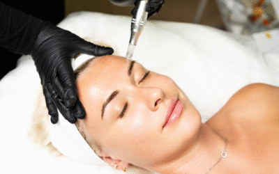 Microneedling, BB Glow & Co. – Welche Gesichtsbehandlung passt zu dir?